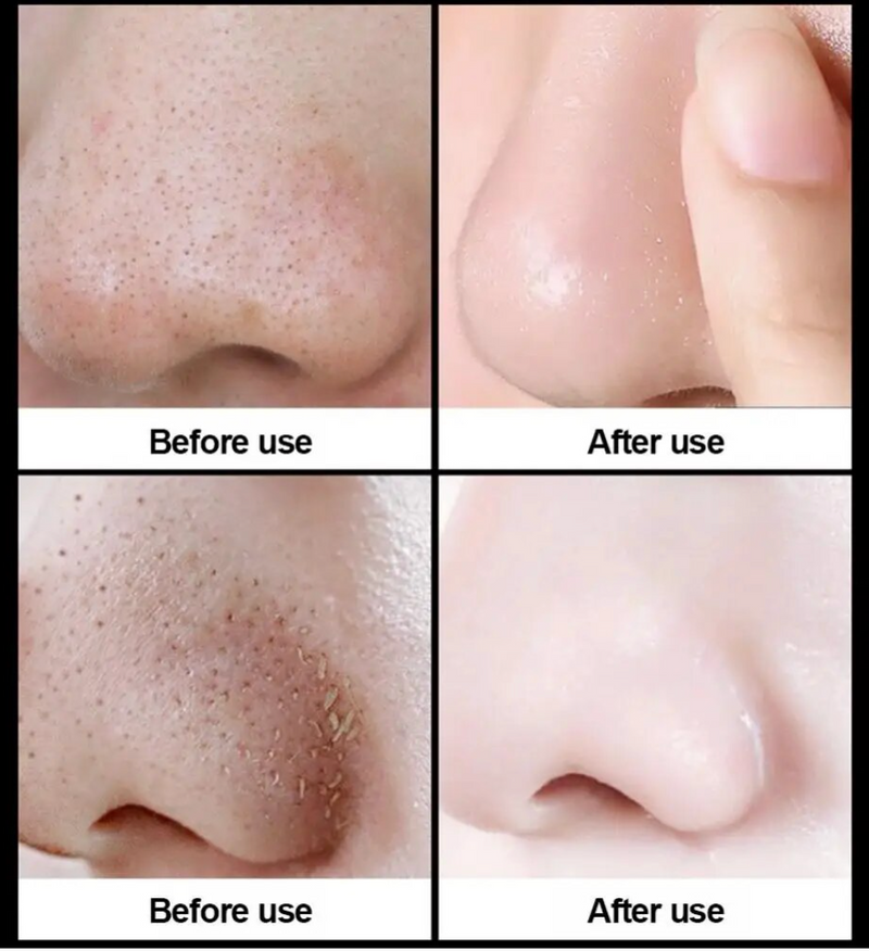 Facial Mask Skin Care
