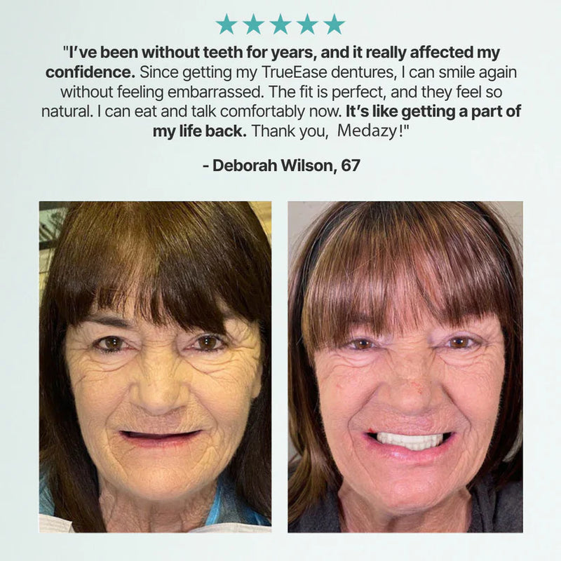 Advanced Custom-Fit Functional Dentures 🦷 Smile Confidently Again in Just 3 Minutes No Dentist Needed! (2)